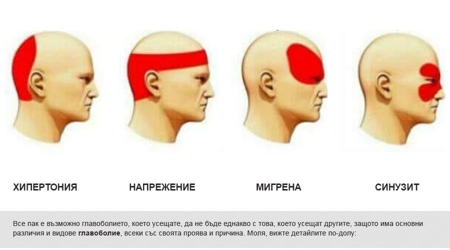 glavobolie_vidove_opisanie_vidove