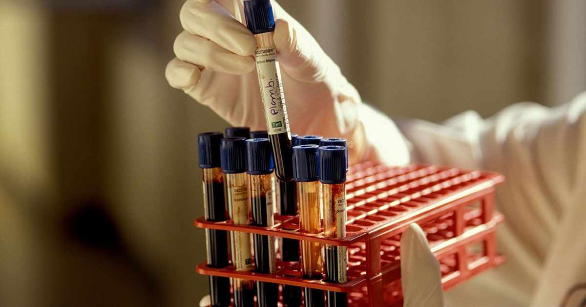 trigliceridi_holesterol_lechenie_5