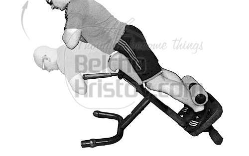 Хиперекстензия