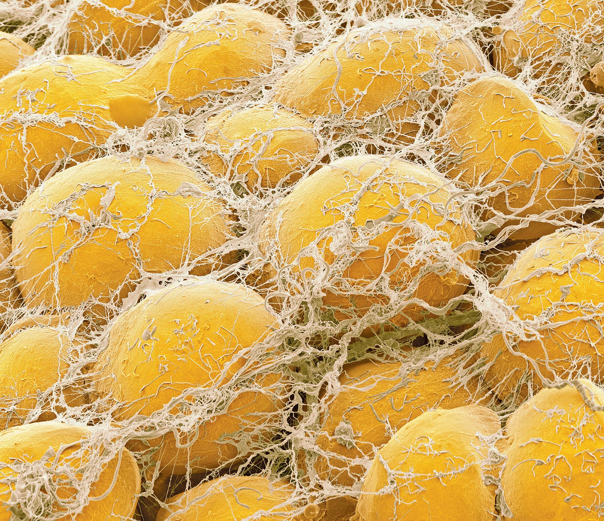 hormoni_maznini_disbalans_2