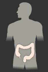 Дебело черво