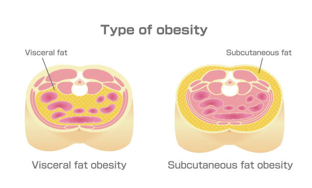 visceralni_maznini_2